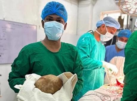 Sri Lanka'da tıp tarihine geçen operasyon: Hastanın mesanesinden 3,1 kiloluk taş çıkarıldı